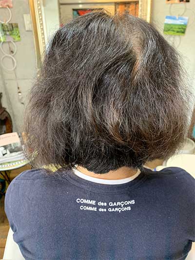 hair-hikaku-before01